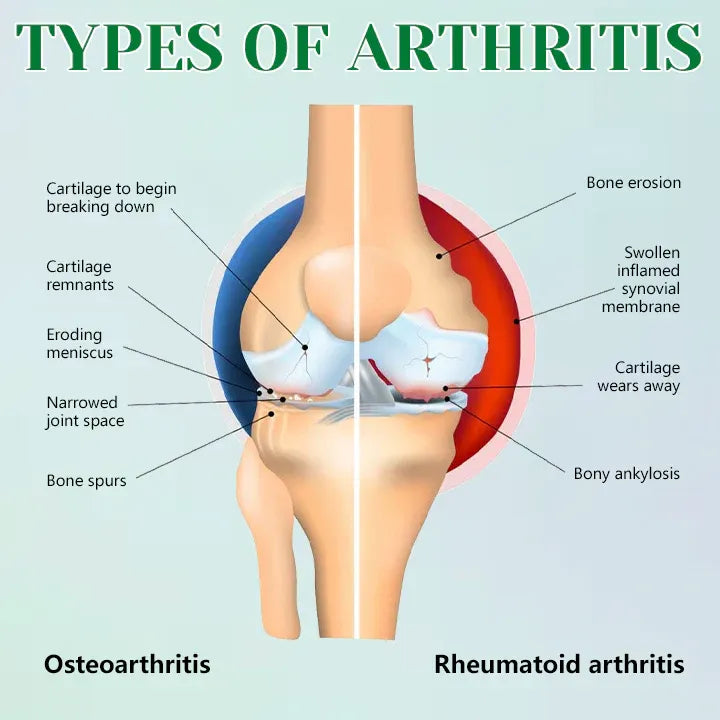 Knee Pain Free Motion Patch