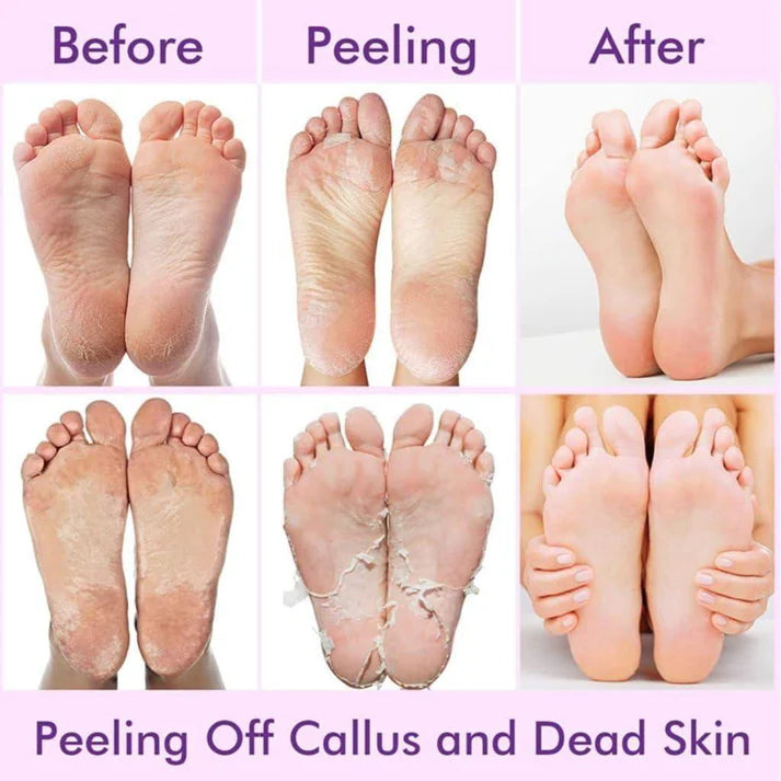 Renew Socks – Deep Hydration & Skin Renewal Foot Therapy