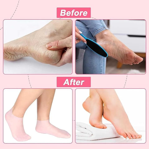 Silicone Gel Heel Socks Anti Slip For Dry Cracked Feet