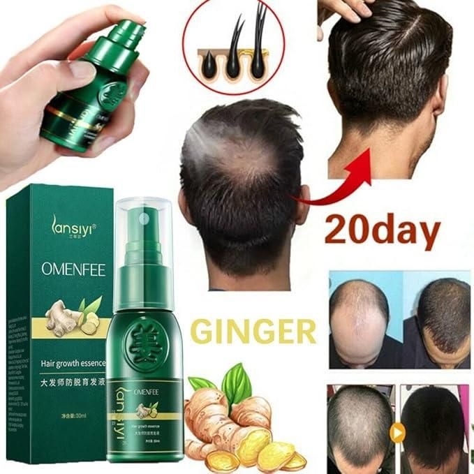 Japanese hair Growth Spray 100ml (Pack of 2)